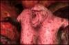 Dragon Age Brood Mother Screens & Trailer